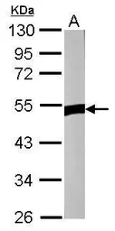 Anti-ZNF322A antibody used in Western Blot (WB). GTX121644