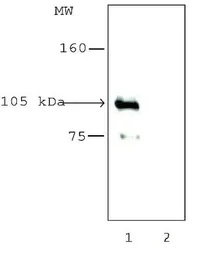 Anti-HDAC7 antibody used in Immunoprecipitation (IP). GTX12174