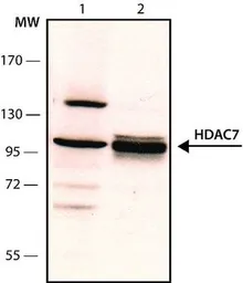 Anti-HDAC7 antibody used in Western Blot (WB). GTX12174