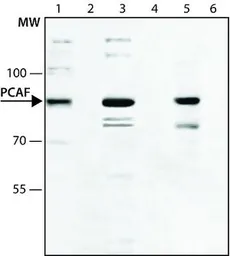 Anti-PCAF antibody used in Western Blot (WB). GTX12188