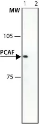 Anti-PCAF antibody used in Western Blot (WB). GTX12188