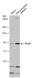 Anti-PCAF antibody used in Western Blot (WB). GTX12188