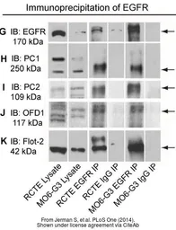 Anti-EGFR antibody [N1-2], N-term used in Western Blot and Immunoprecipitation (WB IP). GTX121919