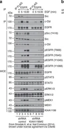 Anti-EGFR antibody [N1-2], N-term used in Western Blot and Immunoprecipitation (WB IP). GTX121919