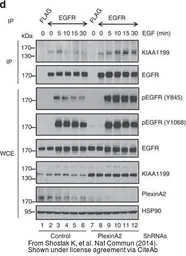 Anti-EGFR antibody [N1-2], N-term used in Western Blot and Immunoprecipitation (WB IP). GTX121919