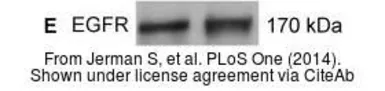 Anti-EGFR antibody [N1-2], N-term used in Western Blot (WB). GTX121919