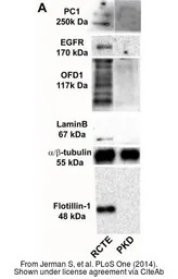 Anti-EGFR antibody [N1-2], N-term used in Western Blot (WB). GTX121919