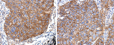 Anti-EGFR antibody [N1-2], N-term used in IHC (Paraffin sections) (IHC-P). GTX121919