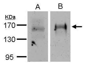 Anti-EGFR antibody [N1-2], N-term used in Immunoprecipitation (IP). GTX121919