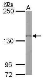 Anti-EGFR antibody [N1-2], N-term used in Western Blot (WB). GTX121919