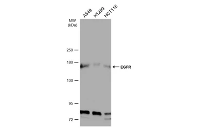 Anti-EGFR antibody [N1-2], N-term used in Western Blot (WB). GTX121919