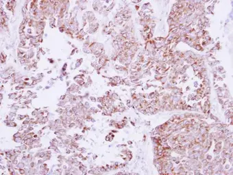 Anti-NOX4 antibody [N3C3] used in IHC (Paraffin sections) (IHC-P). GTX121929