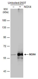 Anti-NOX4 antibody [N3C3] used in Western Blot (WB). GTX121929