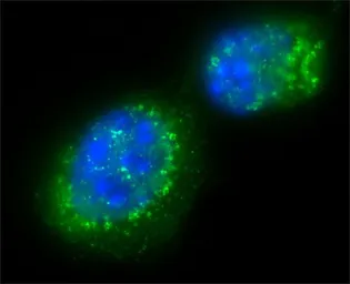 Anti-SIRT2 antibody used in Immunocytochemistry/ Immunofluorescence (ICC/IF). GTX12193