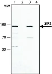 Anti-SIRT2 antibody used in Western Blot (WB). GTX12193