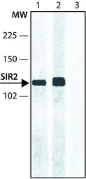 Anti-SIRT2 antibody used in Western Blot (WB). GTX12193