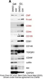 Anti-AKT antibody [N3C2], Internal used in Western Blot (WB). GTX121937