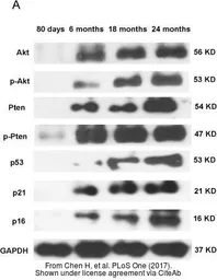 Anti-AKT antibody [N3C2], Internal used in Western Blot (WB). GTX121937