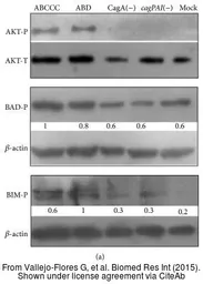 Anti-AKT antibody [N3C2], Internal used in Western Blot (WB). GTX121937