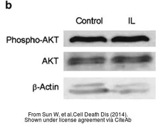 Anti-AKT antibody [N3C2], Internal used in Western Blot (WB). GTX121937