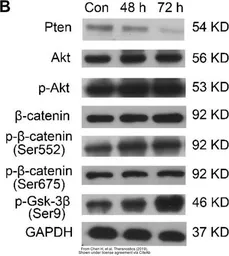 Anti-AKT antibody [N3C2], Internal used in Western Blot (WB). GTX121937