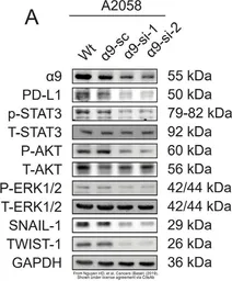 Anti-AKT antibody [N3C2], Internal used in Western Blot (WB). GTX121937