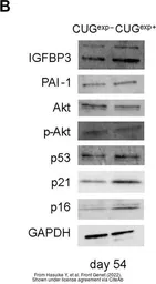 Anti-AKT antibody [N3C2], Internal used in Western Blot (WB). GTX121937