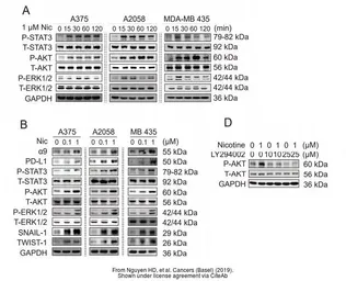 Anti-AKT antibody [N3C2], Internal used in Western Blot (WB). GTX121937