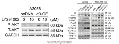 Anti-AKT antibody [N3C2], Internal used in Western Blot (WB). GTX121937