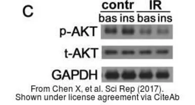 Anti-AKT antibody [N3C2], Internal used in Western Blot (WB). GTX121937