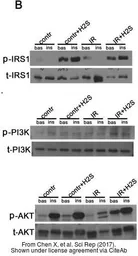 Anti-AKT antibody [N3C2], Internal used in Western Blot (WB). GTX121937