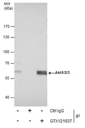 Anti-AKT antibody [N3C2], Internal used in Immunoprecipitation (IP). GTX121937