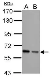 Anti-AKT antibody [N3C2], Internal used in Western Blot (WB). GTX121937