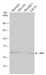 Anti-AKT antibody [N3C2], Internal used in Western Blot (WB). GTX121937