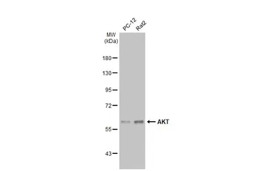 Anti-AKT antibody [N3C2], Internal used in Western Blot (WB). GTX121937