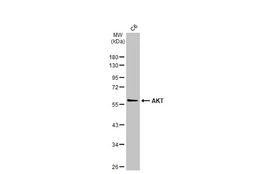 Anti-AKT antibody [N3C2], Internal used in Western Blot (WB). GTX121937