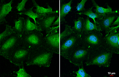 Anti-AKT antibody [N3C2], Internal used in Immunocytochemistry/ Immunofluorescence (ICC/IF). GTX121937