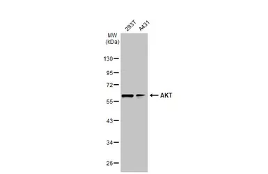 Anti-AKT antibody [N3C2], Internal used in Western Blot (WB). GTX121937