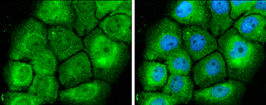 Anti-MEK1 + MEK2 antibody used in Immunocytochemistry/ Immunofluorescence (ICC/IF). GTX121942