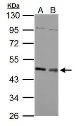 Anti-MEK1 + MEK2 antibody used in Western Blot (WB). GTX121942