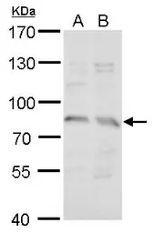 Anti-Syntrophin gamma 2 antibody used in Western Blot (WB). GTX122025