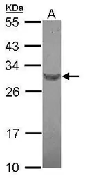 Anti-RFPL4B antibody [N2C3] used in Western Blot (WB). GTX122058