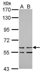 Anti-ZNF419 antibody [N1N3] used in Western Blot (WB). GTX122141