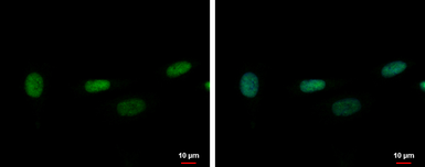 Anti-ZNF419 antibody [N2C2], Internal used in Immunocytochemistry/ Immunofluorescence (ICC/IF). GTX122142