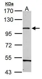 Anti-GRASP1 antibody [N1N2], N-term used in Western Blot (WB). GTX122295