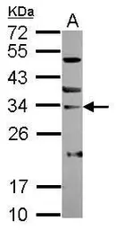 Anti-SNAI3 antibody used in Western Blot (WB). GTX122344