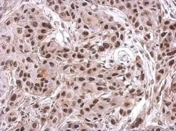 Anti-NIP30 antibody used in IHC (Paraffin sections) (IHC-P). GTX122479