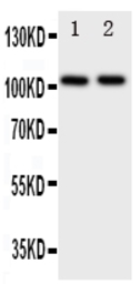 Anti-ZO-3 antibody used in Western Blot (WB). GTX12279