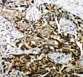 Anti-Hamartin / TSC1 antibody used in IHC (Paraffin sections) (IHC-P). GTX12288