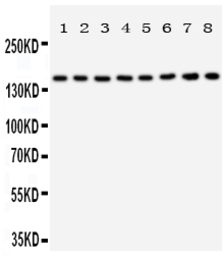 Anti-Hamartin / TSC1 antibody used in Western Blot (WB). GTX12288